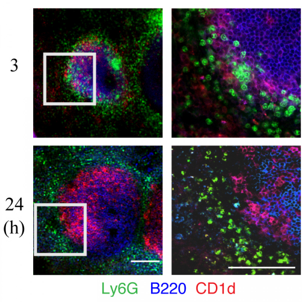 Marginal Zone B Cells Assist With Neutrophil Accumulation to Fight Against Systemic Staphylococcus aureus Infection